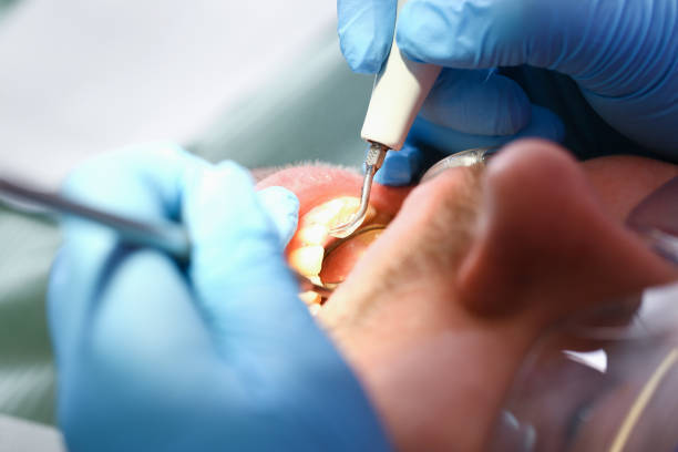 Best Emergency Tooth Extraction  in Byrdstown, TN