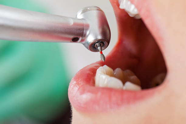 Best Emergency Dental Filling Replacement  in Byrdstown, TN